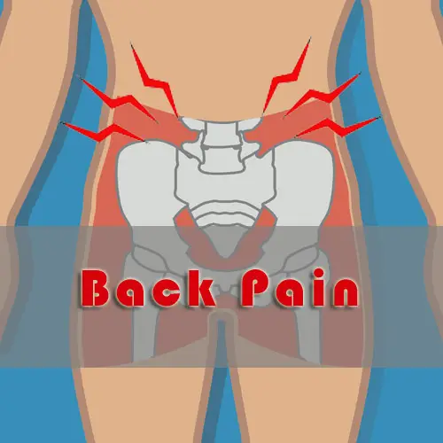 Featured image for “What is the cause of your back pain?”