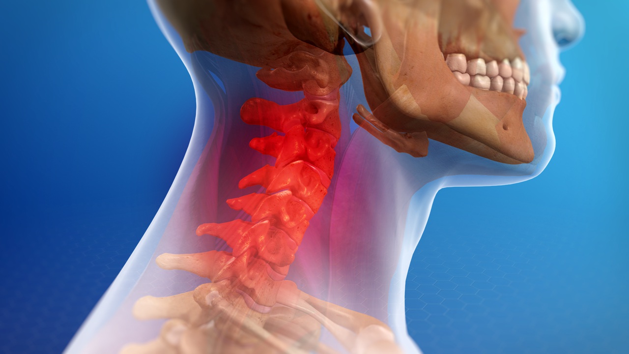 Featured image for “What is a Cervical Strain?”